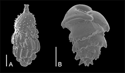 Benthic foraminiferal 