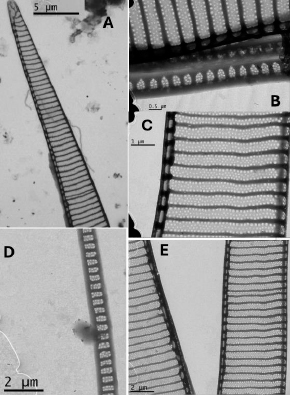 Toxic marine diatoms 